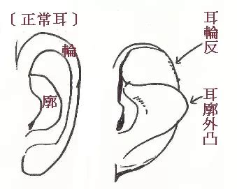 耳朵反骨面相